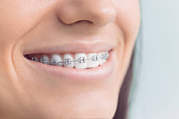 Best Wisdom Tooth Removal  in Sweetser, IN